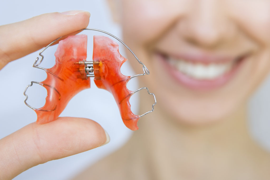 cht ortho braces invisalign hinsdale retainers